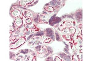 Formalin-fixed and paraffin-embedded H. (RECQL2 antibody  (AA 787-816))