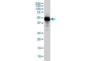 Western Blotting (WB) image for anti-serpin Peptidase Inhibitor, Clade I (neuroserpin), Member 1 (SERPINI1) (AA 17-410) antibody (ABIN562219)