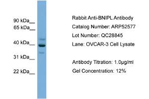 WB Suggested Anti-BNIPL  Antibody Titration: 0. (BNIPL antibody  (Middle Region))