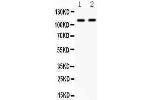 Western Blotting (WB) image for anti-Nucleotide-Binding Oligomerization Domain Containing 1 (NOD1) (AA 1-160) antibody (ABIN3043890) (NOD1 antibody  (AA 1-160))