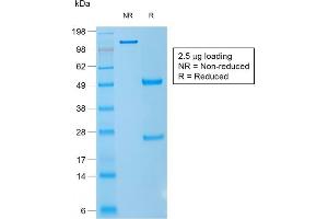SDS-PAGE Analysis Purified CD1a Mouse Recombinant Monoclonal Antibody (rC1A/711). (Recombinant CD1a antibody)