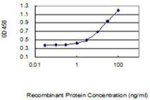 Detection limit for recombinant GST tagged KIAA1191 is 0. (KIAA1191 antibody  (AA 1-305))