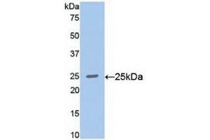 Detection of Recombinant RALA, Human using Polyclonal Antibody to V-Ral Simian Leukemia Viral Oncogene Homolog A (RALA) (rala antibody  (AA 1-206))