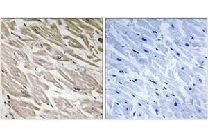 Immunohistochemistry analysis of paraffin-embedded human heart, using PPP1R2 (Phospho-Ser120+Ser121) Antibody. (PPP1R2 antibody  (pSer120))