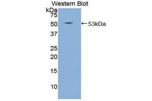 Western Blotting (WB) image for anti-Sema Domain, Immunoglobulin Domain (Ig), Transmembrane Domain (TM) and Short Cytoplasmic Domain, (Semaphorin) 4B (SEMA4B) (AA 644-832) antibody (ABIN1860523) (SEMA4B antibody  (AA 644-832))