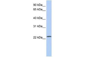 WB Suggested Anti-PIP5KL1 Antibody Titration: 0. (PIP5KL1 antibody  (Middle Region))