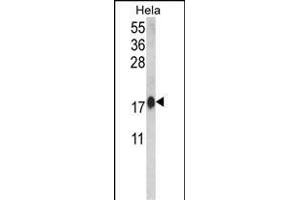 Western blot analysis of CALM1 Antibody (C-term) (ABIN652489 and ABIN2842329) in Hela cell line lysates (35 μg/lane).