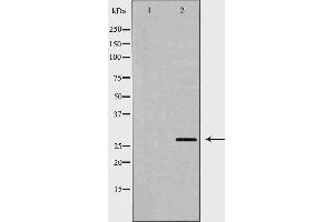 Western blot analysis of A549 whole cell lysates, using PSMA3 Antibody. (PSMA3 antibody  (Internal Region))