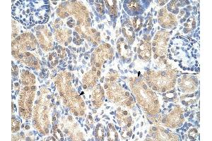PRMT1 antibody was used for immunohistochemistry at a concentration of 4-8 ug/ml to stain Epithelial cells of renal tubule (arrows) in Human Kidney. (PRMT1 antibody  (Middle Region))