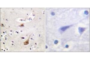 Immunohistochemistry analysis of paraffin-embedded human brain tissue, using Androgen Receptor (Ab-94) Antibody. (Androgen Receptor antibody  (AA 66-115))