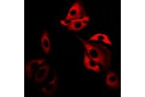 Immunofluorescent analysis of Glutaredoxin staining in SW480 cells. (Glutaredoxin 1 antibody)