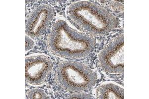 Immunohistochemical staining of human corpus, uterine with YIPF4 polyclonal antibody  shows strong cytoplasmic positivity, with a granular pattern, in glandular cells.