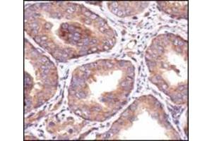 Image no. 1 for anti-Insulin-Like Growth Factor 1 Receptor (IGF1R) (C-Term) antibody (ABIN228595) (IGF1R antibody  (C-Term))