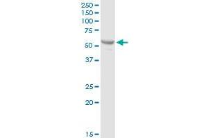 PTPN5 MaxPab rabbit polyclonal antibody. (PTPN5 antibody  (AA 1-565))