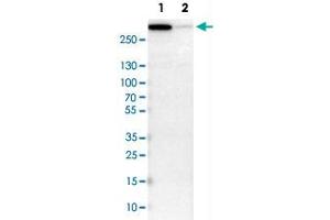 Western Blot analysis of Lane 1: NIH-3T3 cell lysate (mouse embryonic fibroblast cells) and Lane 2: NBT-II cell lysate (Wistar rat bladder tumor cells) with FLNB polyclonal antibody . (FLNB antibody)