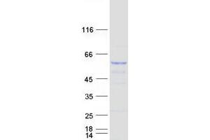 Validation with Western Blot (TAPBPL Protein (Myc-DYKDDDDK Tag))