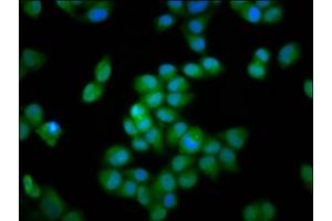 Immunofluorescence staining of Hela cells with ABIN7156413 at 1:66, counter-stained with DAPI. (INTS3 antibody  (AA 901-1043))