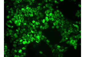 Immunofluorescent staining of mouse embryonic stem (ES) cell line. (Nanog antibody)