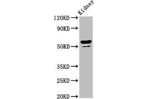 CYP8B1 Antikörper  (AA 303-440)