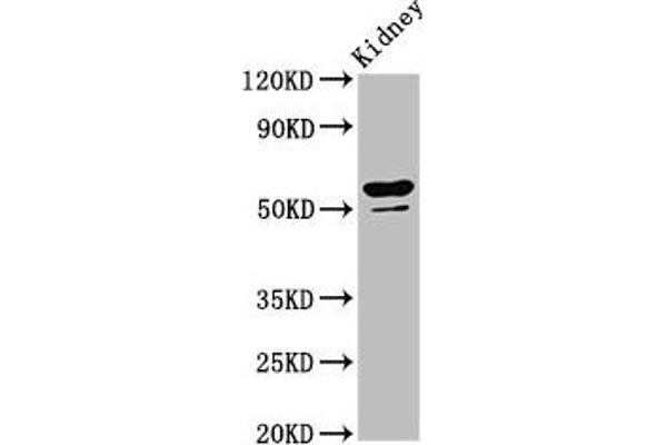 CYP8B1 Antikörper  (AA 303-440)