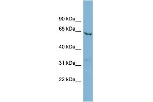WB Suggested Anti-SLC25A21 Antibody Titration:  0. (SLC25A21 antibody  (Middle Region))