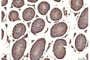 IHC analysis of NAK/TBK1 using anti-NAK/TBK1 antibody (ABIN7599532). (TBK1 antibody  (AA 1-729))