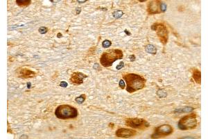 ABIN6257095 and ABIN6275980 at 1/100 staining Rat brain tissue by IHC-P. (CNR1 antibody  (N-Term))