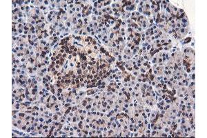 Image no. 4 for anti-F-Box Protein 21 (FBXO21) antibody (ABIN1498232) (FBXO21 antibody)