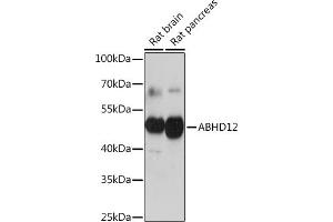 Western blot analysis of extracts of various cell lines, using  Rabbit pAb (ABIN7265355) at 1:1000 dilution. (ABHD12 antibody  (AA 110-250))