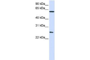 WB Suggested Anti-CCT7  Antibody Titration: 0. (CCT7 antibody  (Middle Region))