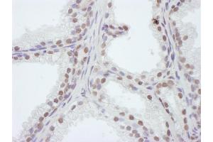 anti-WD Repeat Domain 4 (WDR4) (AA 225-275) antibody