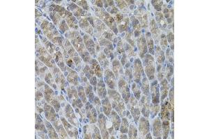 Immunohistochemistry of paraffin-embedded mouse stomach using UBE2A antibody (ABIN6132760, ABIN6149782, ABIN6149784 and ABIN6223686) (40x lens). (UBE2A antibody  (AA 1-152))
