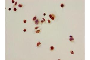 Immunocytochemistry analysis of Hela cells using ABIN7139166 at dilution of 1:100 (HIST1H2BB antibody  (acLys16))