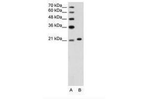 Image no. 3 for anti-Ankyrin 1, Erythrocytic (ANK1) (C-Term) antibody (ABIN203434) (Erythrocyte Ankyrin antibody  (C-Term))