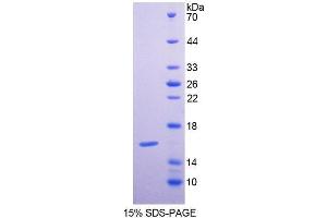 SDS-PAGE analysis of Human GCA Protein. (Grancalcin Protein)