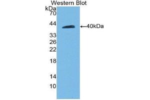 Western Blotting (WB) image for anti-Cadherin 5 (CDH5) (AA 59-382) antibody (ABIN1858328) (Cadherin 5 antibody  (AA 59-382))