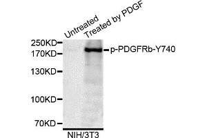 Western blot analysis of extracts of NIH/3T3 cells, using Phospho-PDGFRb-Y740 antibody. (PDGFRB antibody)