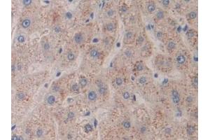 Detection of FLNC in Human Liver Tissue using Polyclonal Antibody to Filamin C Gamma (FLNC) (FLNC antibody  (AA 17-259))