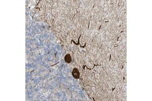 Immunohistochemical staining of human cerebellum with SEMA3F polyclonal antibody  shows strong cytoplasmic positivity in Purkinje cells.