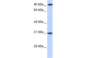 WB Suggested Anti-ANKRA2 Antibody Titration:  0. (ANKRA2 antibody  (C-Term))