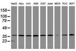 Image no. 3 for anti-Apurinic/Apyrimidinic Endonuclease 1 (APEX1) (AA 1-242) antibody (ABIN1490626) (APEX1 antibody  (AA 1-242))