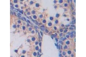 IHC-P analysis of Human Tissue, with DAB staining. (SLC2A14 antibody  (AA 51-105))