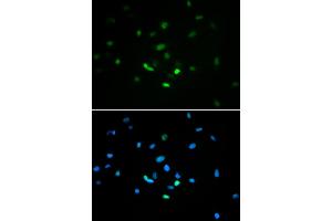 Immunofluorescence analysis of MCF-7 cells using TP53 antibody (ABIN5971632).