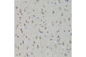 Immunohistochemistry of paraffin-embedded mouse brain using DDX1 Antibody. (DDX1 antibody  (AA 441-740))