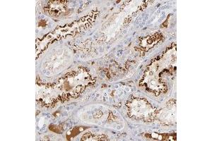 Immunohistochemical staining (Formalin-fixed paraffin-embedded sections) of human kidney shows extra-cellular positivity in blood vessels and strong cytoplasmic positivity in renal tubules. (APOH antibody)