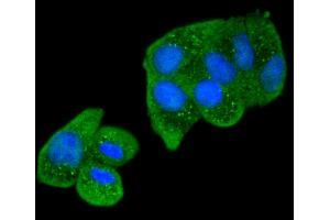 Hela cells were stained with Smad2 (9A3) Monoclonal Antibody  at [1:200] incubated for overnight at 4C followed by secondary antibody incubation, DAPI staining of the nuclei and detection. (SMAD2 antibody)