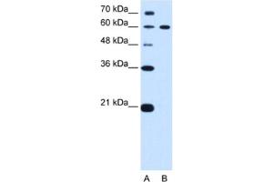 Western Blotting (WB) image for anti-Deltex Homolog 2 (DTX2) antibody (ABIN2462679)