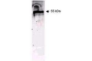 Western blot using ROCKLAND Immunochemical's Mouse Anti-Keratin antibody. (pan Keratin antibody)