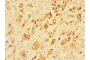 Immunohistochemistry of paraffin-embedded human placenta tissue using ABIN7146737 at dilution of 1:100 (CA11 antibody  (AA 24-328))