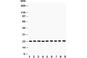 Western blot testing of PRDX1 antibody and Lane 1:  rat brain;  2: mouse brain;  3: human U87;  4: (m) Neuro-2a;  5: (h) A375;  6: (h) 293T;  7: (h) SMMC;  8: (h) A549;  9: (h) RH35 lysate. (Peroxiredoxin 1 antibody  (Middle Region))